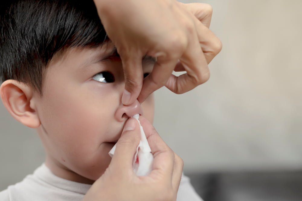 Domácí první pomoc – Krvácení z nosu